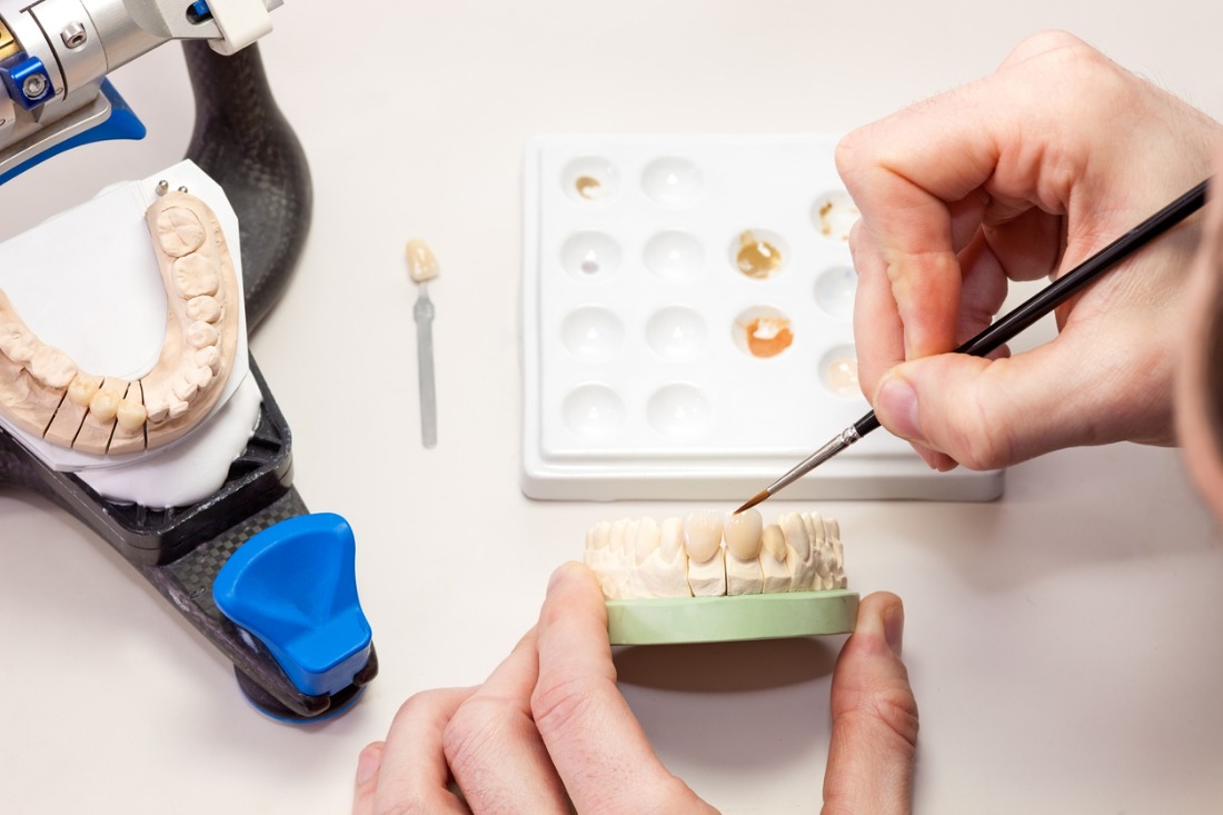 Rafforzare il ruolo dell’odontotecnico come fabbricante